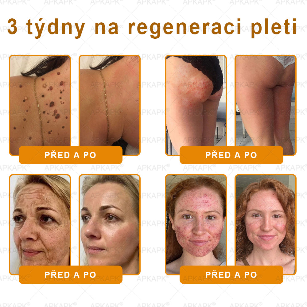 Lenaro® Krém s včelím jedem na obnovu pokožky 🍀 pomáhá při řešení kožních problémů, jako jsou: vrásky, jizvy, pigmentové skvrny, strie, akné, lupénka, ekzém, kožní léze, podráždění, záněty a další kožní potíže.