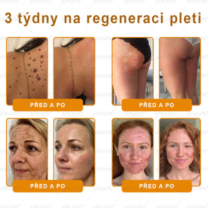 Lenaro® Krém s včelím jedem na obnovu pokožky 🍀 pomáhá při řešení kožních problémů, jako jsou: vrásky, jizvy, pigmentové skvrny, strie, akné, lupénka, ekzém, kožní léze, podráždění, záněty a další kožní potíže.
