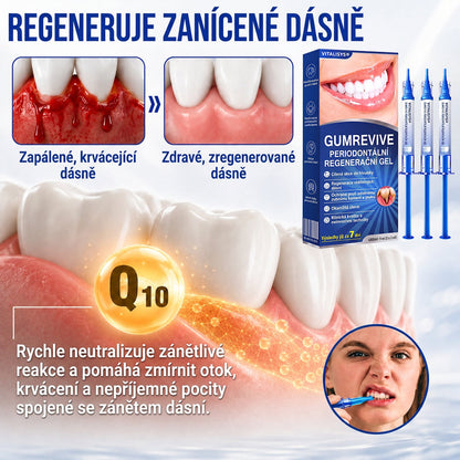 🇨🇿 VITALISYS®🦷 𝑮𝒖𝒎𝑹𝒆𝒗𝒊𝒗𝒆 Parodontální regenerační gel🍇