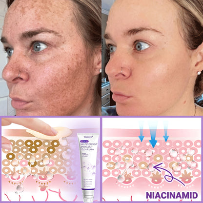 Vitalisys®🍋 PDRN Multi-Peptide Masážní tělový krém s válečkem — proti stárnutí, hydratuje, zpevňuje a liftinguje pokožku, podporuje regeneraci, sjednocuje tón pleti a pečuje o nedokonalosti a tmavé skvrny.