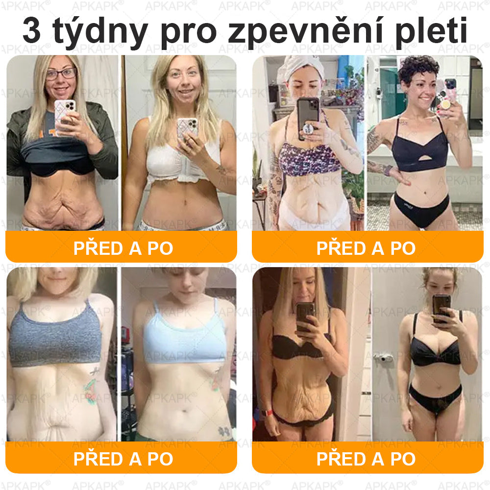 Lenaro® Krém s včelím jedem na obnovu pokožky 🍀 pomáhá při řešení kožních problémů, jako jsou: vrásky, jizvy, pigmentové skvrny, strie, akné, lupénka, ekzém, kožní léze, podráždění, záněty a další kožní potíže.