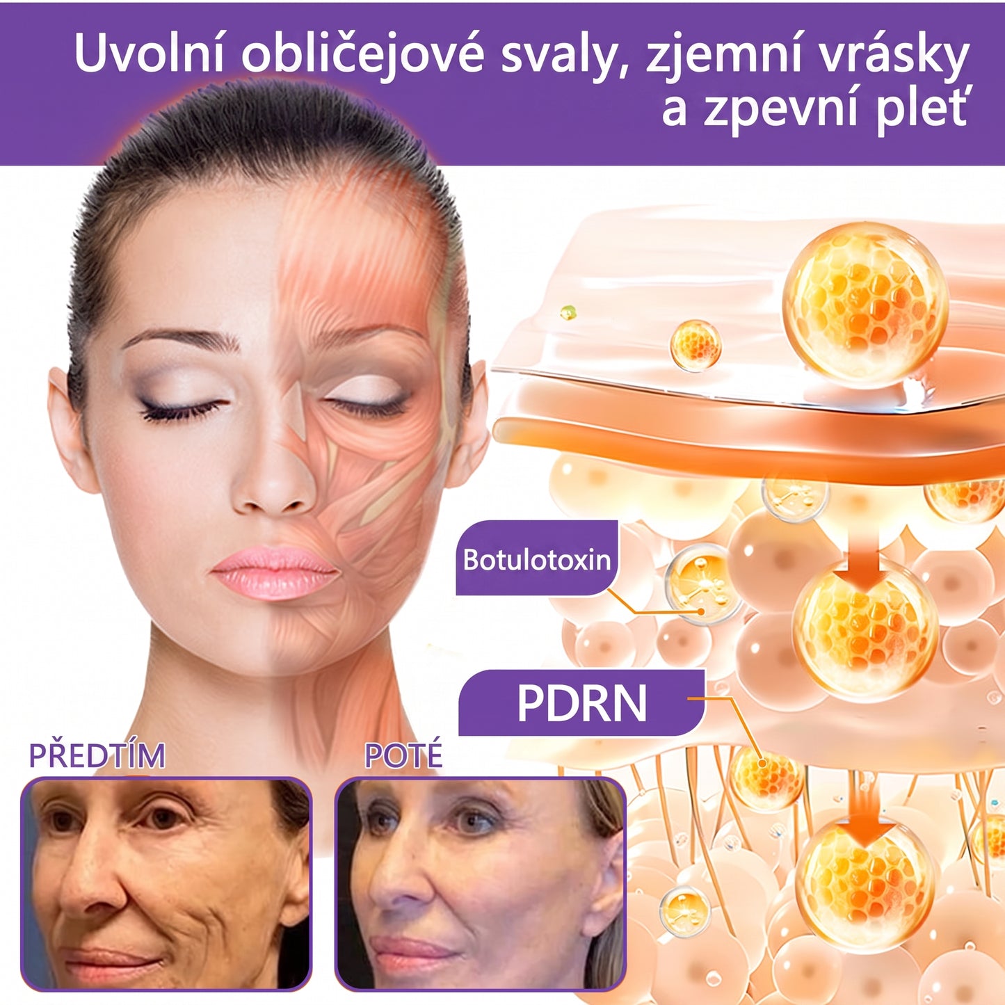 Vitalisys®🍋 PDRN Multi-Peptide Masážní tělový krém s válečkem — proti stárnutí, hydratuje, zpevňuje a liftinguje pokožku, podporuje regeneraci, sjednocuje tón pleti a pečuje o nedokonalosti a tmavé skvrny.