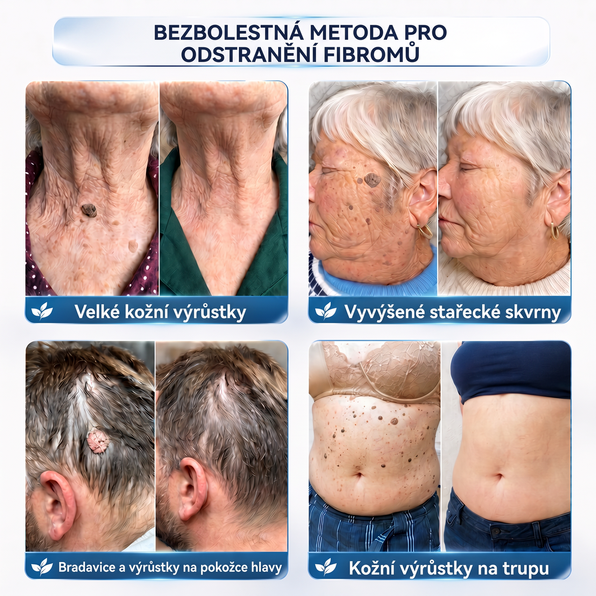 👩‍⚕️💖Vitalisys® 𝟕𝐝𝐞𝐧𝐧í 𝐤𝐫é𝐦 𝐧𝐚 𝐨𝐝𝐬𝐭𝐫𝐚𝐧ě𝐧í 𝐤𝐨ž𝐧í𝐜𝐡 𝐯ý𝐫ů𝐬𝐭𝐤ů 𝐚 𝐬𝐤𝐯𝐫𝐧 (𝐁𝐞𝐳𝐛𝐨𝐥𝐞𝐬𝐭𝐧á 𝐟𝐨𝐫𝐦𝐮𝐥𝐚 – 𝐁𝐞𝐳 𝐣𝐢𝐳𝐞𝐯)🍈