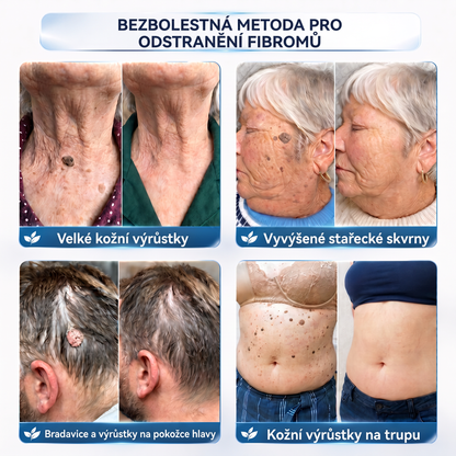 👩‍⚕️💖Vitalisys® 𝟕𝐝𝐞𝐧𝐧í 𝐤𝐫é𝐦 𝐧𝐚 𝐨𝐝𝐬𝐭𝐫𝐚𝐧ě𝐧í 𝐤𝐨ž𝐧í𝐜𝐡 𝐯ý𝐫ů𝐬𝐭𝐤ů 𝐚 𝐬𝐤𝐯𝐫𝐧 (𝐁𝐞𝐳𝐛𝐨𝐥𝐞𝐬𝐭𝐧á 𝐟𝐨𝐫𝐦𝐮𝐥𝐚 – 𝐁𝐞𝐳 𝐣𝐢𝐳𝐞𝐯)🍈
