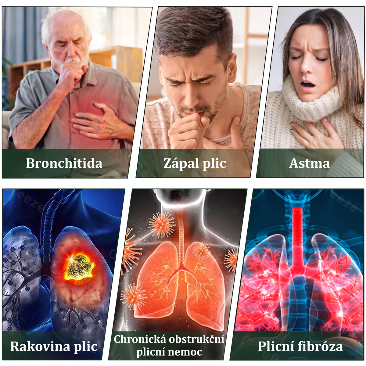 🇨🇿 Vysoce kvalitní český produkt s doručením po celé ČR ❤️ Murwon® bylinný inhalátor pro očistu plic🥐(👨‍⚕️ Účinná pomoc při: kašli, bolesti v krku, dušnosti, zahlenění, ucpaném nosu, zánětu průdušek, alergických příznacích a plicních potížích)🍈