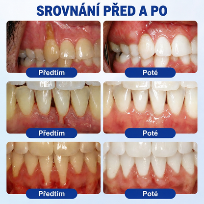 🇨🇿 VITALISYS®🦷 𝑮𝒖𝒎𝑹𝒆𝒗𝒊𝒗𝒆 Parodontální regenerační gel🍇