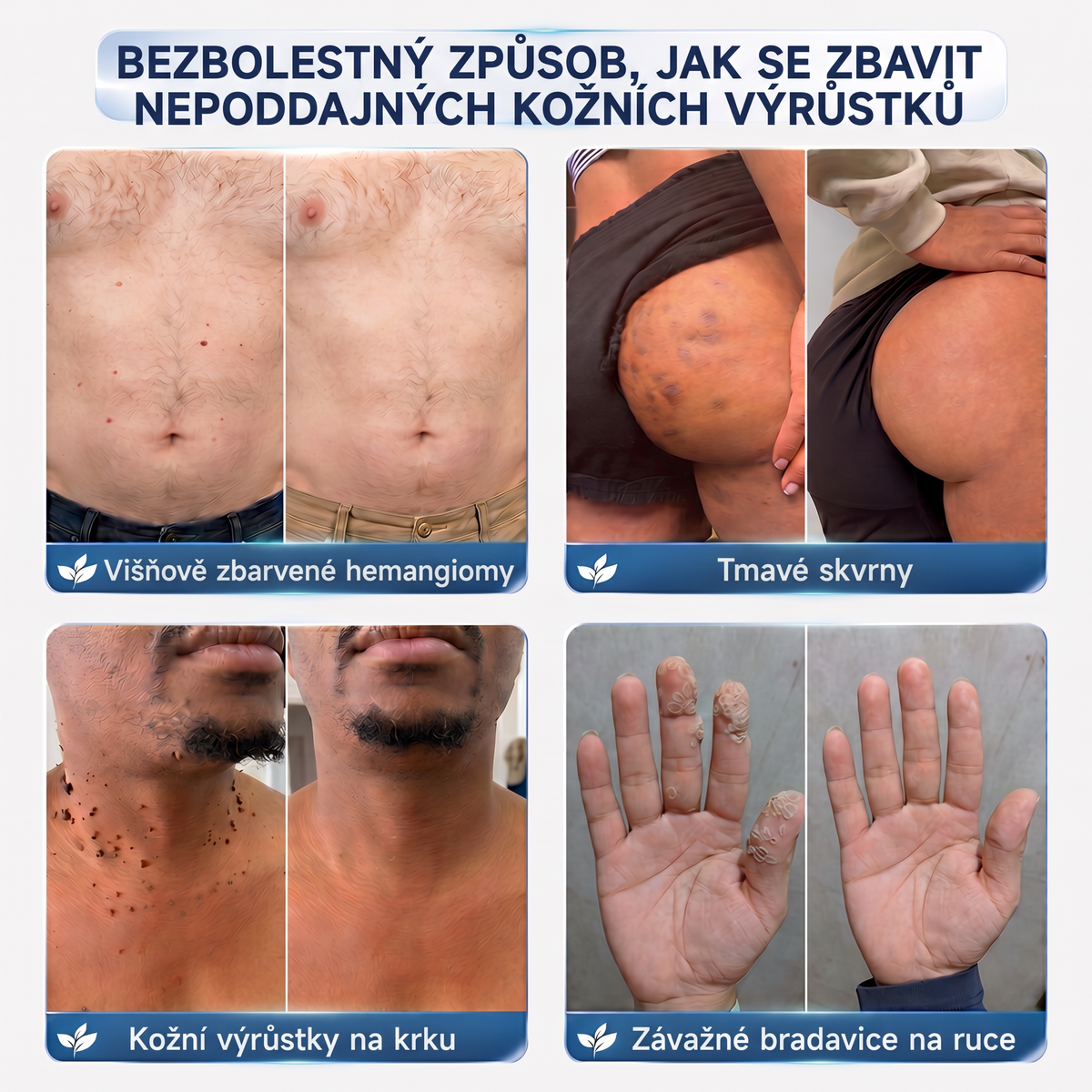 👩‍⚕️💖Vitalisys® 𝟕𝐝𝐞𝐧𝐧í 𝐤𝐫é𝐦 𝐧𝐚 𝐨𝐝𝐬𝐭𝐫𝐚𝐧ě𝐧í 𝐤𝐨ž𝐧í𝐜𝐡 𝐯ý𝐫ů𝐬𝐭𝐤ů 𝐚 𝐬𝐤𝐯𝐫𝐧 (𝐁𝐞𝐳𝐛𝐨𝐥𝐞𝐬𝐭𝐧á 𝐟𝐨𝐫𝐦𝐮𝐥𝐚 – 𝐁𝐞𝐳 𝐣𝐢𝐳𝐞𝐯)🍈