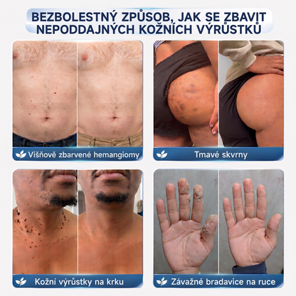 👩‍⚕️💖Vitalisys® 𝟕𝐝𝐞𝐧𝐧í 𝐤𝐫é𝐦 𝐧𝐚 𝐨𝐝𝐬𝐭𝐫𝐚𝐧ě𝐧í 𝐤𝐨ž𝐧í𝐜𝐡 𝐯ý𝐫ů𝐬𝐭𝐤ů 𝐚 𝐬𝐤𝐯𝐫𝐧 (𝐁𝐞𝐳𝐛𝐨𝐥𝐞𝐬𝐭𝐧á 𝐟𝐨𝐫𝐦𝐮𝐥𝐚 – 𝐁𝐞𝐳 𝐣𝐢𝐳𝐞𝐯)🍈
