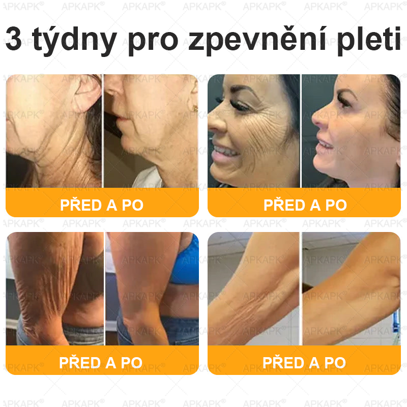 Lenaro® Krém s včelím jedem na obnovu pokožky 🍀 pomáhá při řešení kožních problémů, jako jsou: vrásky, jizvy, pigmentové skvrny, strie, akné, lupénka, ekzém, kožní léze, podráždění, záněty a další kožní potíže.