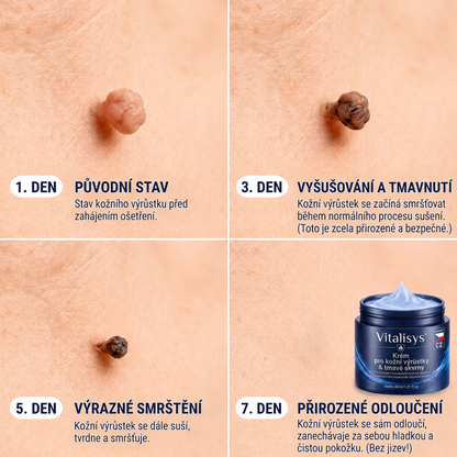 👩‍⚕️💖Vitalisys® 𝟕𝐝𝐞𝐧𝐧í 𝐤𝐫é𝐦 𝐧𝐚 𝐨𝐝𝐬𝐭𝐫𝐚𝐧ě𝐧í 𝐤𝐨ž𝐧í𝐜𝐡 𝐯ý𝐫ů𝐬𝐭𝐤ů 𝐚 𝐬𝐤𝐯𝐫𝐧 (𝐁𝐞𝐳𝐛𝐨𝐥𝐞𝐬𝐭𝐧á 𝐟𝐨𝐫𝐦𝐮𝐥𝐚 – 𝐁𝐞𝐳 𝐣𝐢𝐳𝐞𝐯)🍈