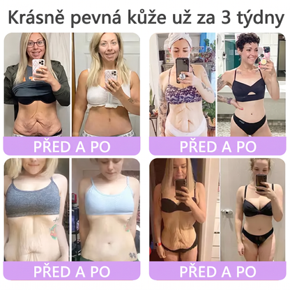 Vitalisys®🍋 PDRN Multi-Peptide Masážní tělový krém s válečkem — proti stárnutí, hydratuje, zpevňuje a liftinguje pokožku, podporuje regeneraci, sjednocuje tón pleti a pečuje o nedokonalosti a tmavé skvrny.
