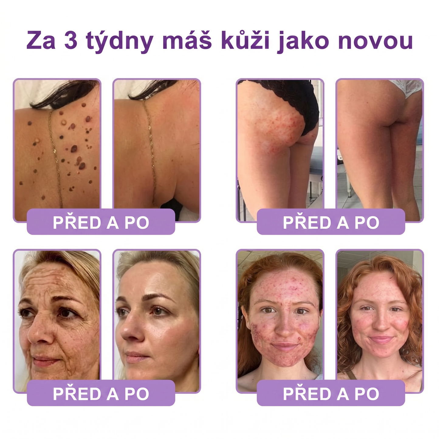 Vitalisys®🍋 PDRN Multi-Peptide Masážní tělový krém s válečkem — proti stárnutí, hydratuje, zpevňuje a liftinguje pokožku, podporuje regeneraci, sjednocuje tón pleti a pečuje o nedokonalosti a tmavé skvrny.