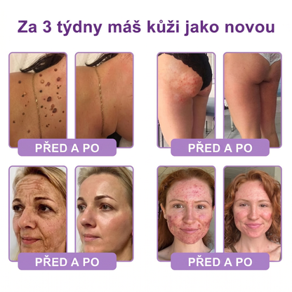 Vitalisys®🍋 PDRN Multi-Peptide Masážní tělový krém s válečkem — proti stárnutí, hydratuje, zpevňuje a liftinguje pokožku, podporuje regeneraci, sjednocuje tón pleti a pečuje o nedokonalosti a tmavé skvrny.