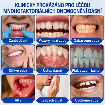 🇨🇿 VITALISYS®🦷 𝑮𝒖𝒎𝑹𝒆𝒗𝒊𝒗𝒆 Parodontální regenerační gel🍇