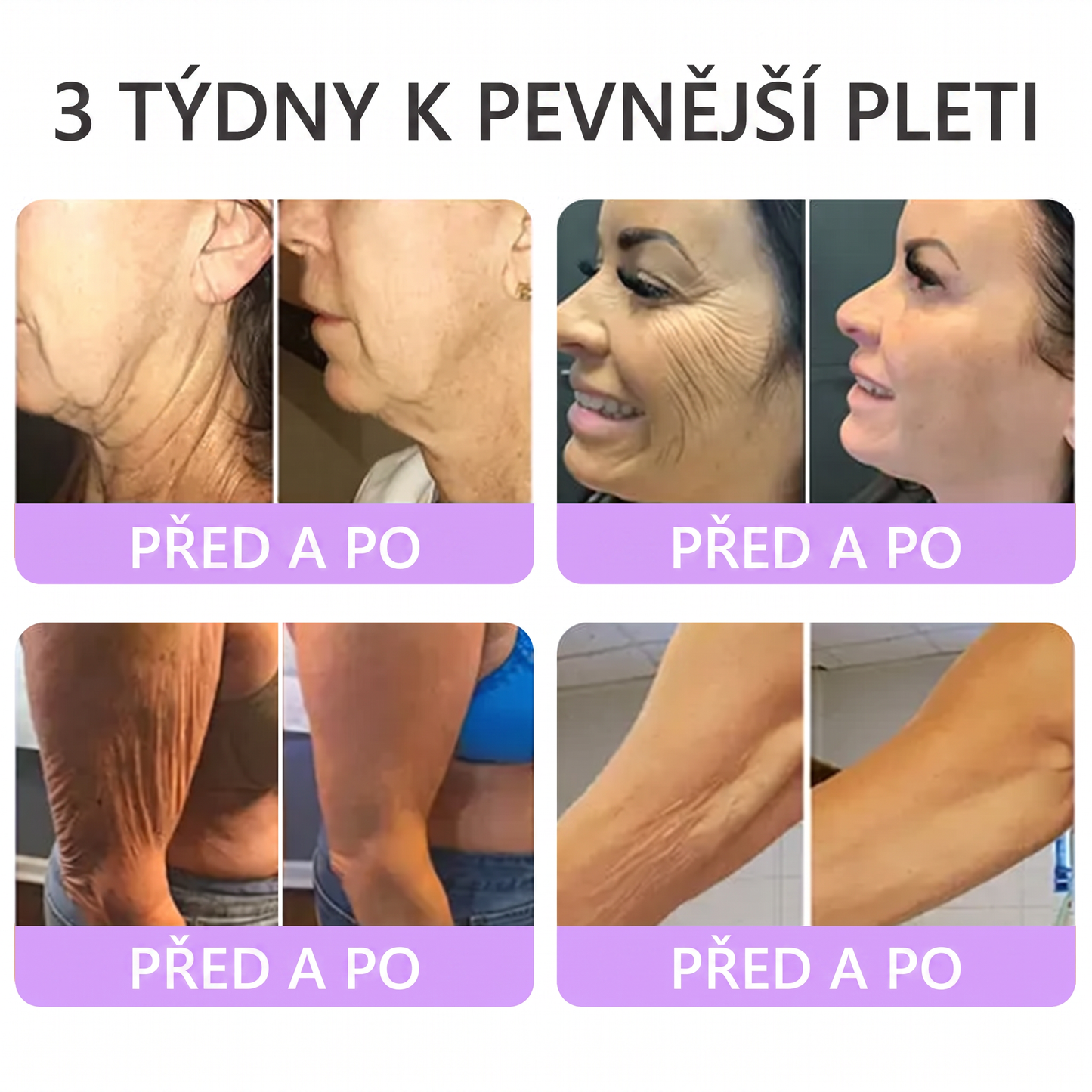 Vitalisys®🍋 PDRN Multi-Peptide Masážní tělový krém s válečkem — proti stárnutí, hydratuje, zpevňuje a liftinguje pokožku, podporuje regeneraci, sjednocuje tón pleti a pečuje o nedokonalosti a tmavé skvrny.