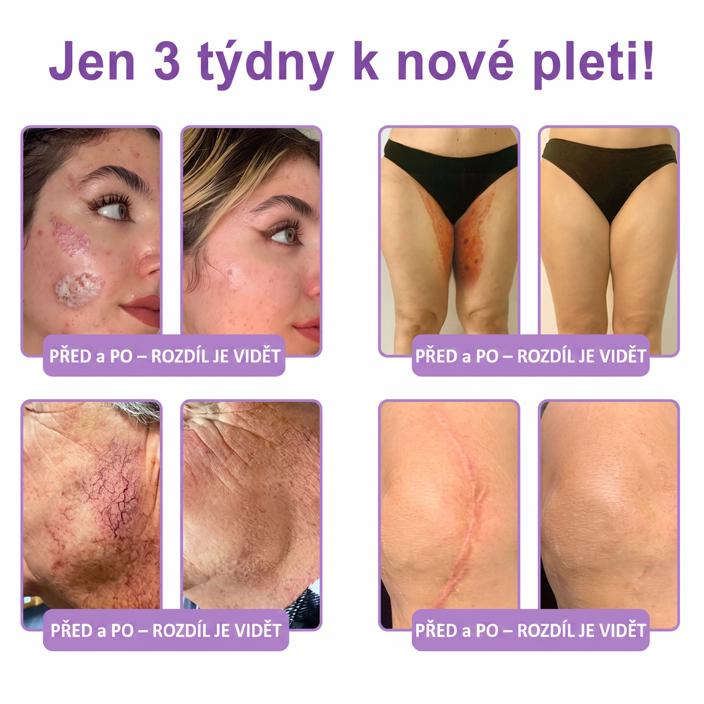 Vitalisys®🍋 PDRN Multi-Peptide Masážní tělový krém s válečkem — proti stárnutí, hydratuje, zpevňuje a liftinguje pokožku, podporuje regeneraci, sjednocuje tón pleti a pečuje o nedokonalosti a tmavé skvrny.