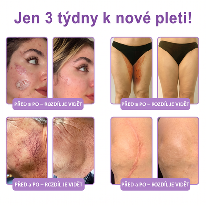 Vitalisys®🍋 PDRN Multi-Peptide Masážní tělový krém s válečkem — proti stárnutí, hydratuje, zpevňuje a liftinguje pokožku, podporuje regeneraci, sjednocuje tón pleti a pečuje o nedokonalosti a tmavé skvrny.