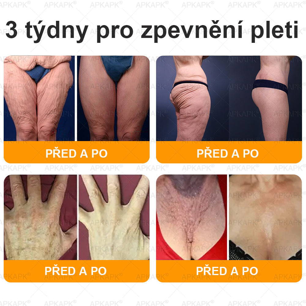 Lenaro® Krém s včelím jedem na obnovu pokožky 🍀 pomáhá při řešení kožních problémů, jako jsou: vrásky, jizvy, pigmentové skvrny, strie, akné, lupénka, ekzém, kožní léze, podráždění, záněty a další kožní potíže.