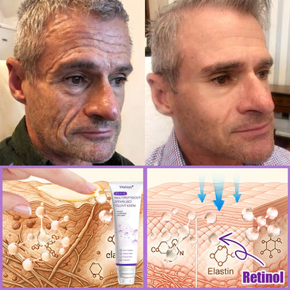 Vitalisys®🍋 PDRN Multi-Peptide Masážní tělový krém s válečkem — proti stárnutí, hydratuje, zpevňuje a liftinguje pokožku, podporuje regeneraci, sjednocuje tón pleti a pečuje o nedokonalosti a tmavé skvrny.