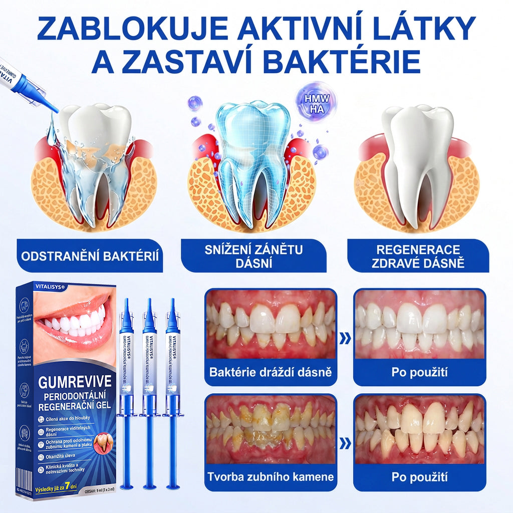 🇨🇿 VITALISYS®🦷 𝑮𝒖𝒎𝑹𝒆𝒗𝒊𝒗𝒆 Parodontální regenerační gel🍇