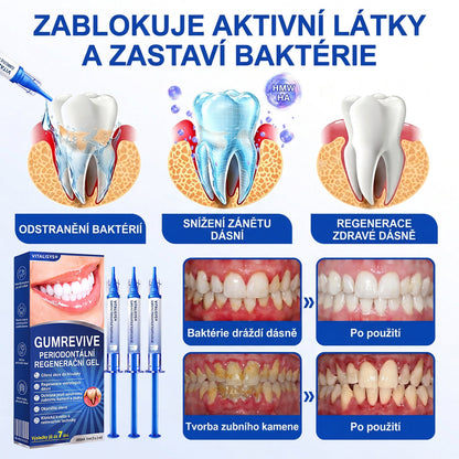 🇨🇿 VITALISYS®🦷 𝑮𝒖𝒎𝑹𝒆𝒗𝒊𝒗𝒆 Parodontální regenerační gel🍇
